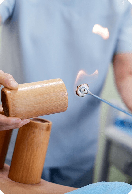 TCM Therapy Image